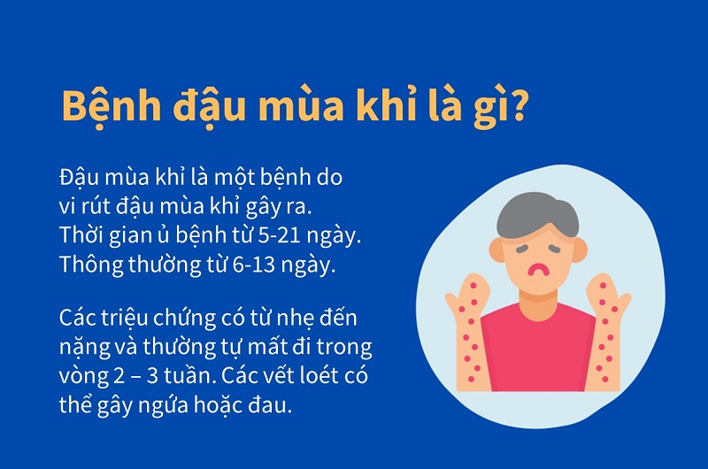 Bệnh đậu mùa khỉ, triệu chứng và cách phòng bệnh